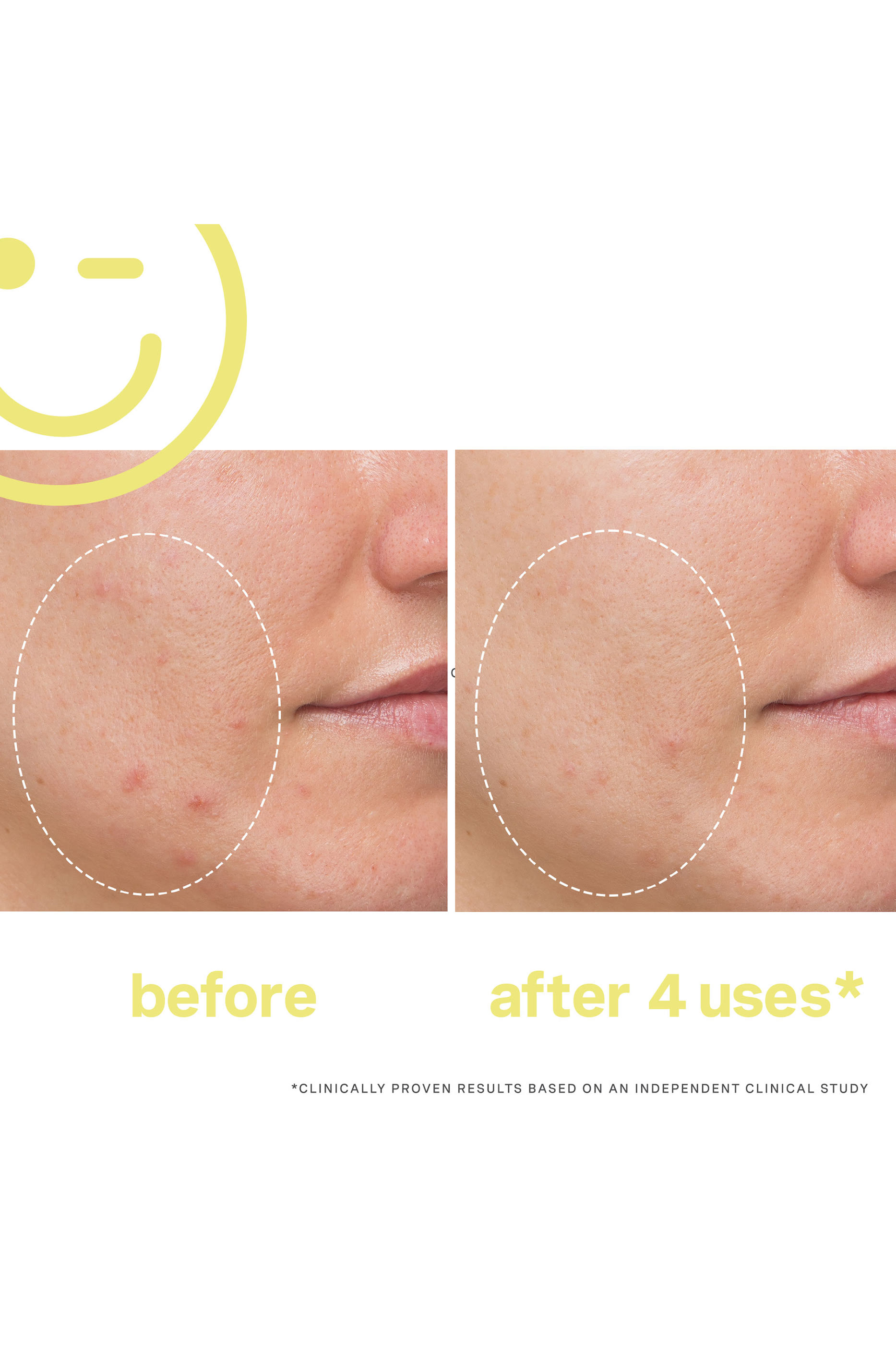 MEGA-C&trade; 30% Vitamin C Brightening Facial