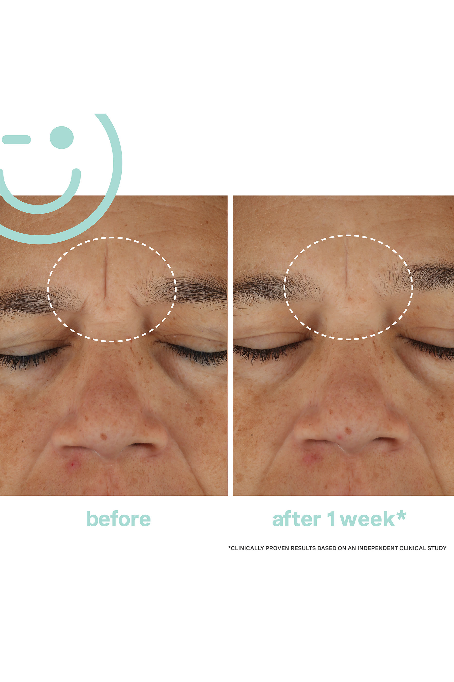 HydraKate&trade; Recharging Water Cream