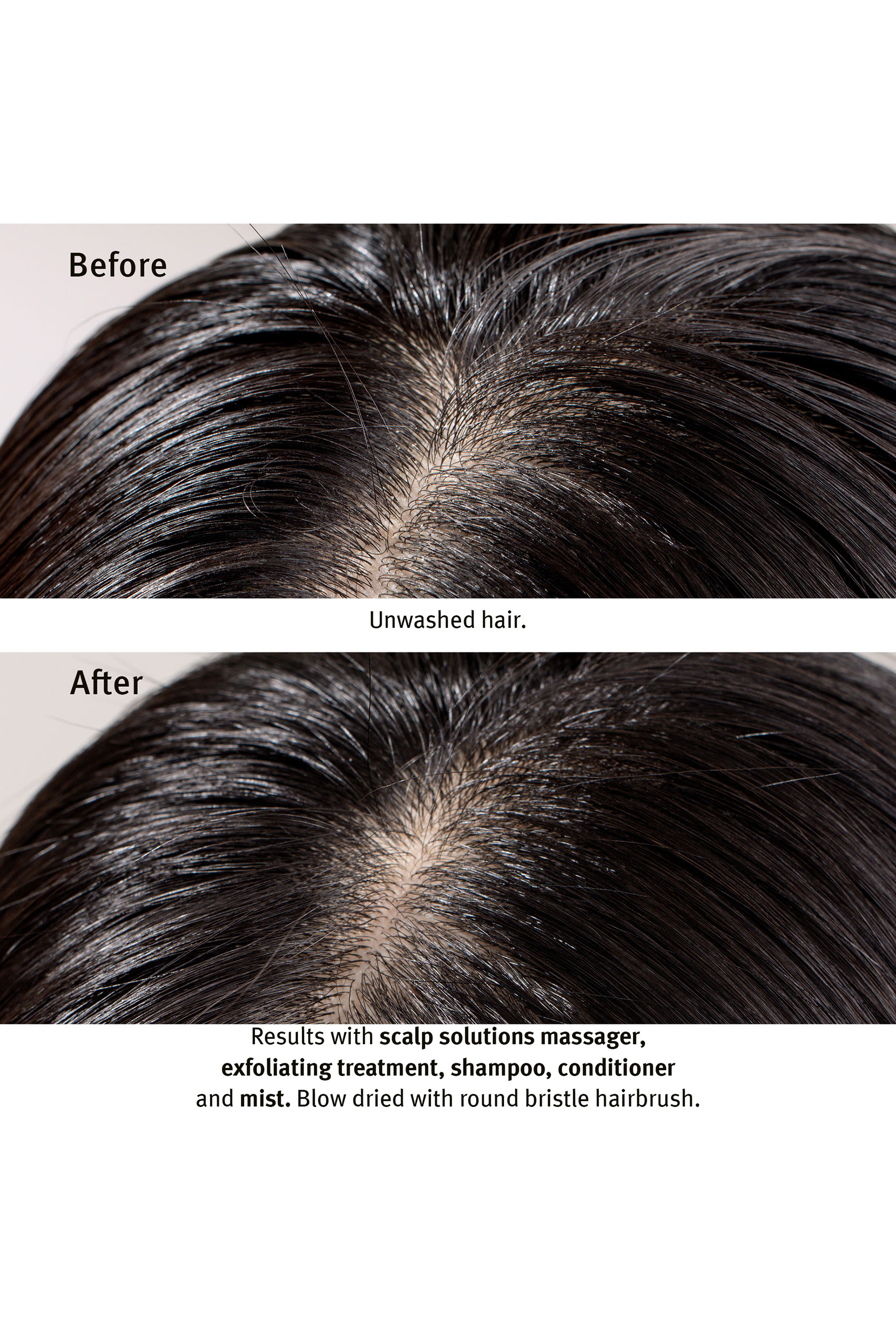 Scalp Solutions Balancing Shampoo