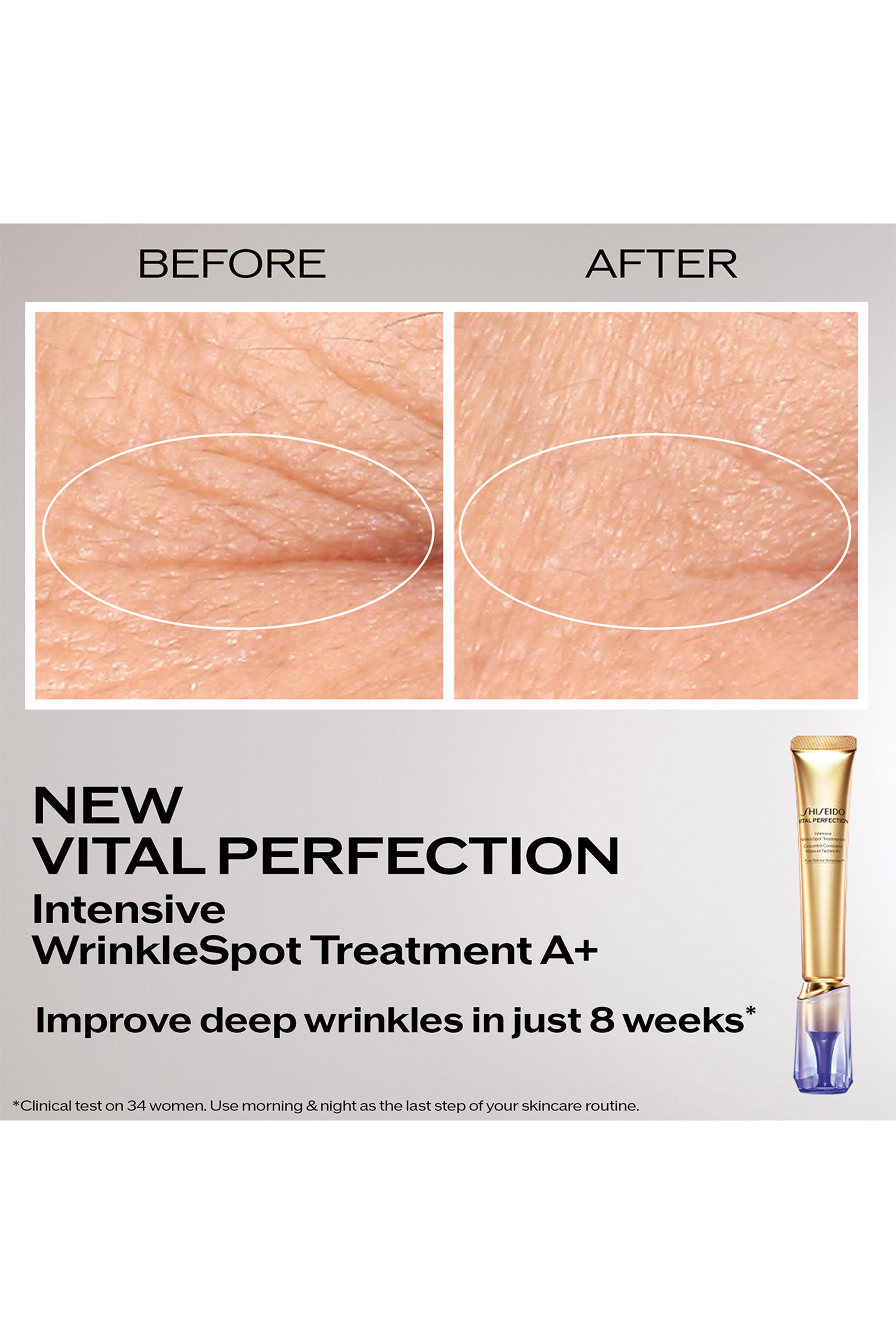 Vital Perfection Intensive WrinkleSpot Treatment A+